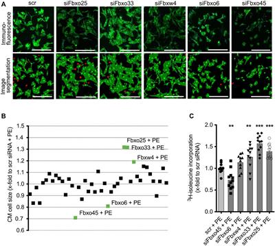 Identification of hypertrophy-modulating Cullin-RING ubiquitin ligases in primary cardiomyocytes